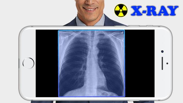 X-Ray Body Scanner Prank