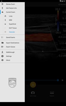Philips Lumify Ultrasound App