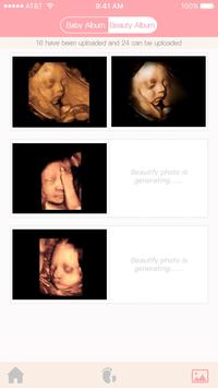 Fetus Camera