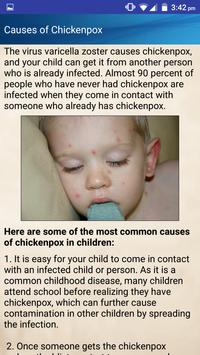 Chicken Pox in Kids Causes Treatment Help