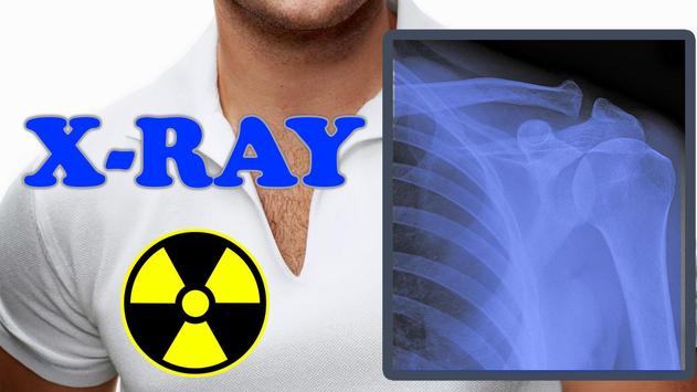 X-Ray Body Scanner Prank